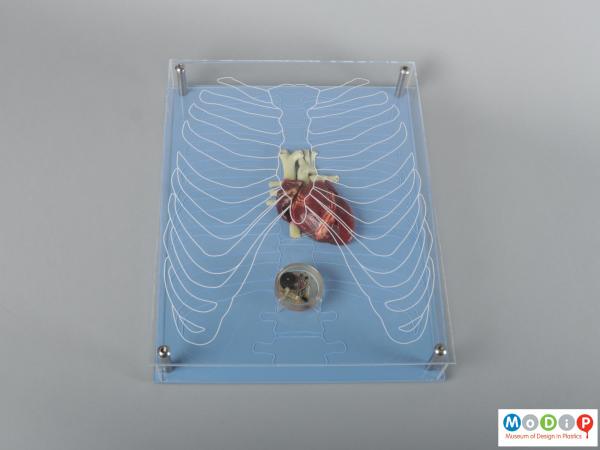 Front view of a model of a pacemaker showing the heart, device and ribs.